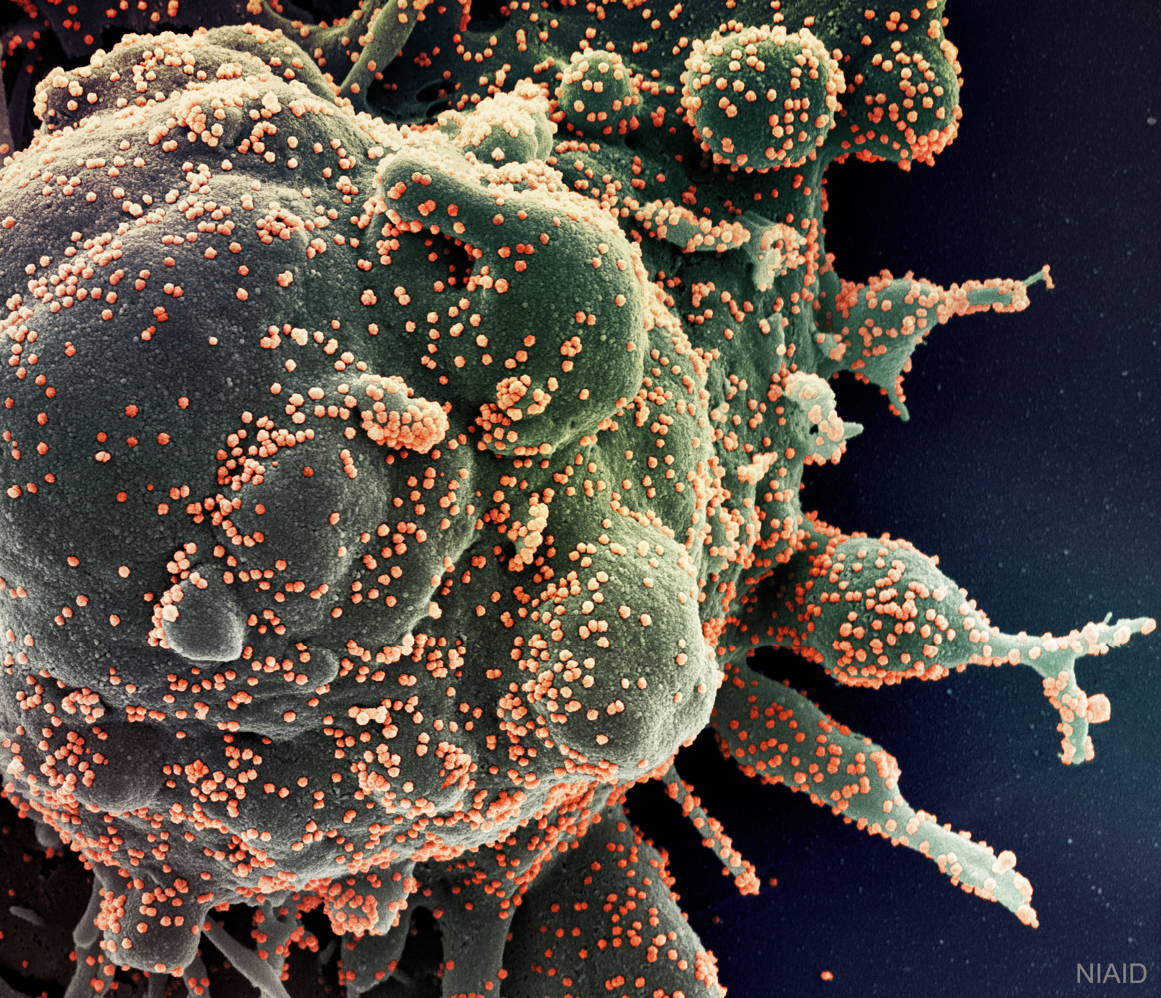 Humanity is under attack. The attack is not from large tentacle-flailing aliens, but from invaders so small they can barely be seen, and so strange they are not even clearly alive.  All over planet Earth, the human home world, DNA-based humans are being invaded by the RNA-based SARS-CoV2.  The virus, which creates a disease known as  COVID-19, specializes in reprogramming human cells into zombies that manufacture and release copies of itself.   Pictured here is a high magnification image of a human cell covered by attacking novel coronavirus SARS-CoV2 (orange).  Epic battles where two species square off in a fight to the death are not unusual on Earth, with several just involving humans typically ongoing at any time.  Even so, most humans are predicted to survive. After several years, humanity expects to win this war -- but only after millions of humans have died and trillions of coronaviruses have been destroyed.   Wash your hands: Tips for humans on how to survive this SARS-CoV2 assault